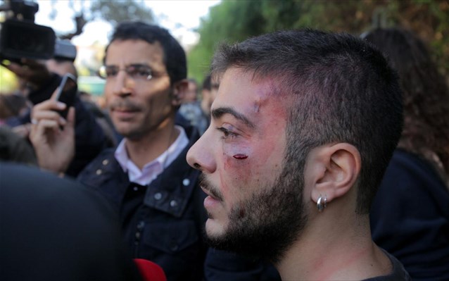 Απρόκλητη επίθεση των ΜΑΤ σε φοιτητές καταγγέλλει η Νεολαία ΣΥΡΙΖΑ