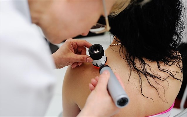 dermatoskopio-dermatologos