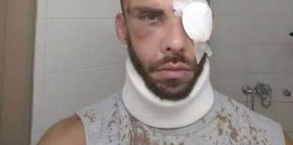 Άγριος ξυλοδαρμός 30χρονου στο Ρέθυμνο