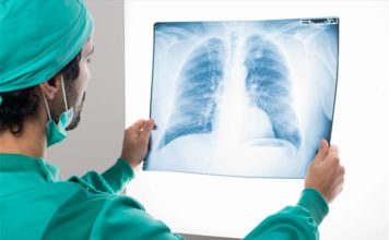 Ξεκίνησε το 1ο Μητρώο Ασθενών με Καρκίνο του Πνεύμονα στην Ελλάδα