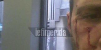 Αγριο ξύλο σε οδοντίατρο