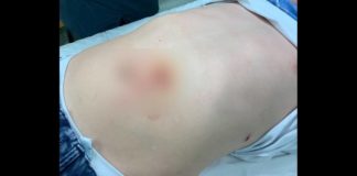 11χρονος καρφώθηκε στα κάγκελα εκκλησίας