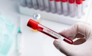 Οι τέσσερις μελέτες για τον κορωνοϊό που θα «τρέξουν» το επόμενο διάστημα