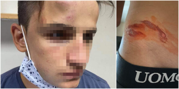 mathitis-xylo-galatsi