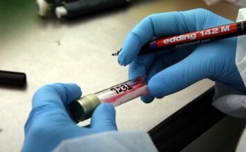 Ευλογιά των πιθήκων: Σε ετοιμότητα το Ινστιτούτο Παστέρ για κρούσματα στην Ελλάδα