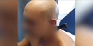 Στο νοσοκομείο με το μαχαίρι που του κάρφωσε στο λαιμό η κουμπάρα του – Εξελίξεις στην υπόθεση