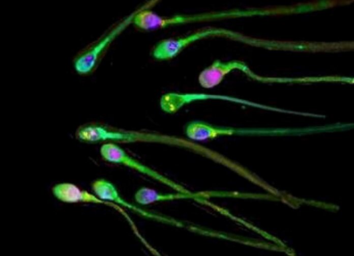 sperma-1536x1109