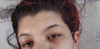 «Έπαθα πνευμονική εμβολή από τον κορωνοϊό»