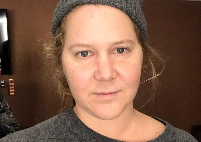 amy-schumer-1