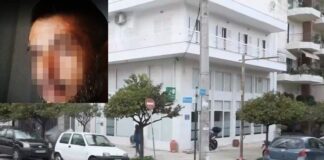 Την έδειρε τόσο που νόμιζαν ότι ήταν θύμα τροχαίου