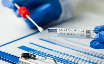 PCR test: Στα 47 ευρώ η τιμή τους