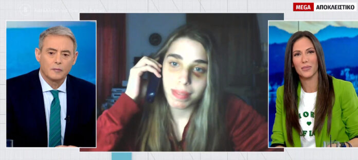 listis-1