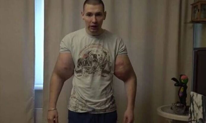 popey
