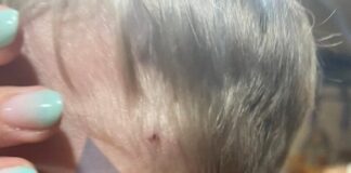 Αδέσποτο σκυλί επιτέθηκε σε παιδί 3 ετών