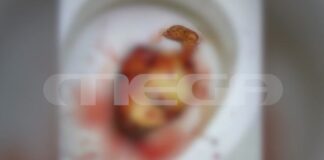 «Δεν ήξερα ότι ήμουν έγκυος» – Ένιωσε έντονο πόνο και… γέννησε μέσα σε λεκάνη τουαλέτας