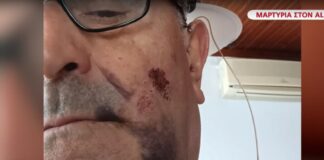 Άγρια επίθεση καταγγέλλει ο πρόεδρος των Πομάκων στην Ξάνθη: «Υποψιάζομαι ανθρώπους του Ερντογάν»