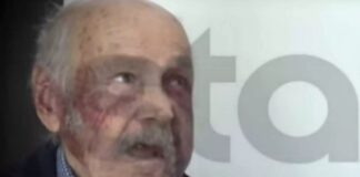 «Μου έβγαλαν τα δόντια»
