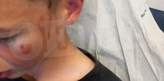 «Τον κάνανε τσουβάλι στις κλωτσιές»