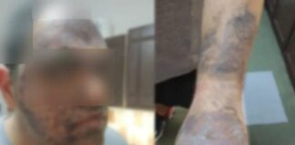 «Δεν κάλεσαν το ΕΚΑΒ επειδή τον είχαν ανασφάλιστο»