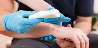 Δάγκωμα φιδιού: Τι να κάνετε σε περίπτωση που σας συμβεί
