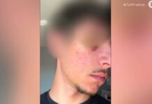 «Θα τον σκότωναν, κάποιοι επικροτούσαν τον δράστη και γελούσαν»