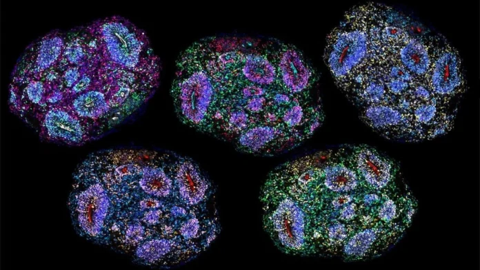 5a628f33-brain-organoids