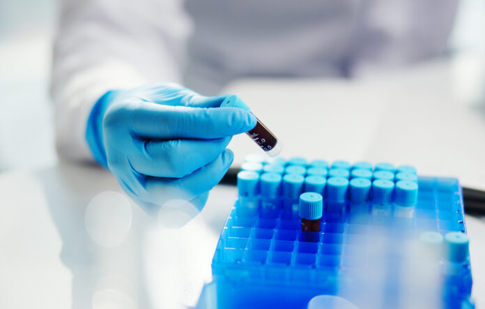 vials-of-blood