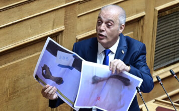 Σάλος με τις φωτογραφίες οστών που έδειξε ο Βελόπουλος στη Βουλή – «Είναι από ζώα»